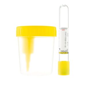 Envase Colector de Orina por Vacío de 120 ml - Amarillo